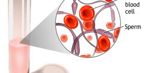 Blood-in-the-semen