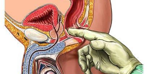 Prostate