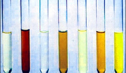The presence of blood in urine