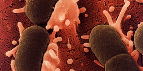 Tract-infections