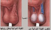 Funiculus
