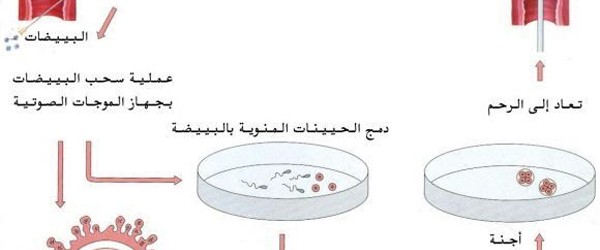 IVF-and-ICSI IVF-and-ICSI