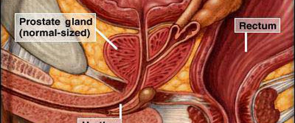 Prostate
